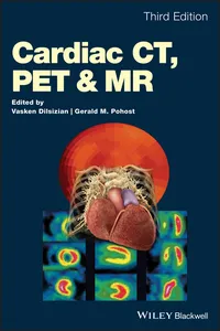 Cardiac CT, PET and MR_cover