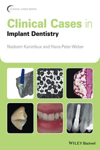 Clinical Cases in Implant Dentistry_cover