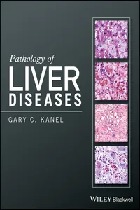 Pathology of Liver Diseases_cover
