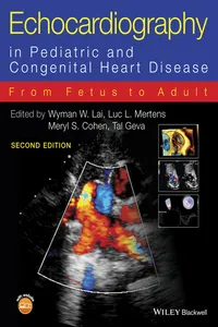 Echocardiography in Pediatric and Congenital Heart Disease_cover