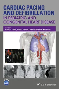 Cardiac Pacing and Defibrillation in Pediatric and Congenital Heart Disease_cover