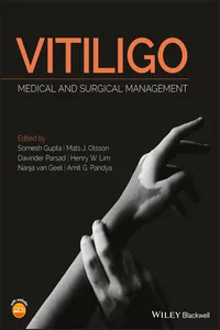 Vitiligo_cover