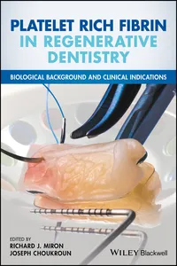 Platelet Rich Fibrin in Regenerative Dentistry_cover