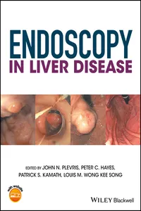Endoscopy in Liver Disease_cover
