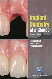 Implant Dentistry at a Glance_cover