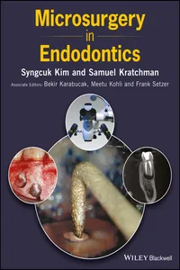 Microsurgery in Endodontics_cover