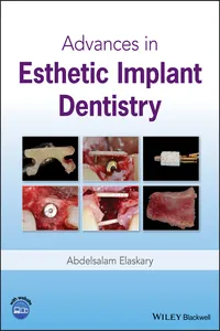 Advances in Esthetic Implant Dentistry_cover