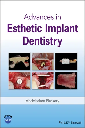 Advances in Esthetic Implant Dentistry