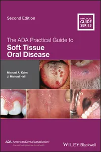 The ADA Practical Guide to Soft Tissue Oral Disease_cover