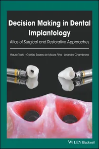 Decision Making in Dental Implantology_cover