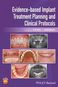 Evidence-based Implant Treatment Planning and Clinical Protocols_cover