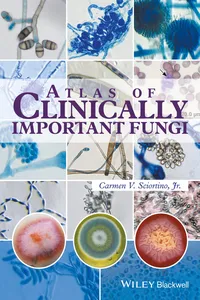 Atlas of Clinically Important Fungi_cover