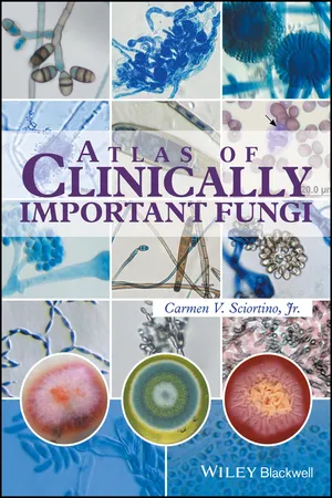 Atlas of Clinically Important Fungi