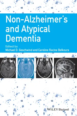 Non-Alzheimer's and Atypical Dementia