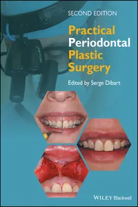 Practical Periodontal Plastic Surgery_cover