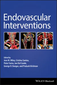 Endovascular Interventions_cover