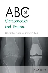 ABC of Orthopaedics and Trauma_cover
