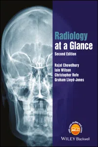 Radiology at a Glance_cover