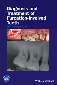 Diagnosis and Treatment of Furcation-Involved Teeth_cover