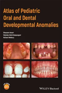 Atlas of Pediatric Oral and Dental Developmental Anomalies_cover