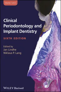 Clinical Periodontology and Implant Dentistry, 2 Volume Set_cover