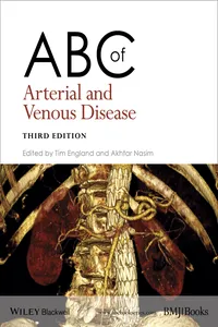 ABC of Arterial and Venous Disease_cover