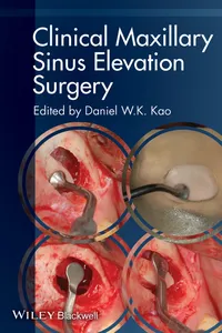 Clinical Maxillary Sinus Elevation Surgery_cover