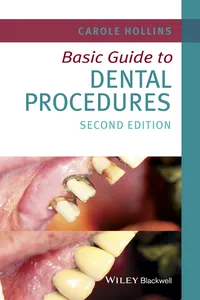 Basic Guide to Dental Procedures_cover