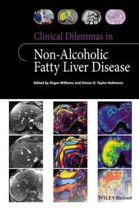 Clinical Dilemmas in Non-Alcoholic Fatty Liver Disease_cover