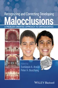 Recognizing and Correcting Developing Malocclusions_cover