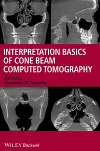 Interpretation Basics of Cone Beam Computed Tomography_cover