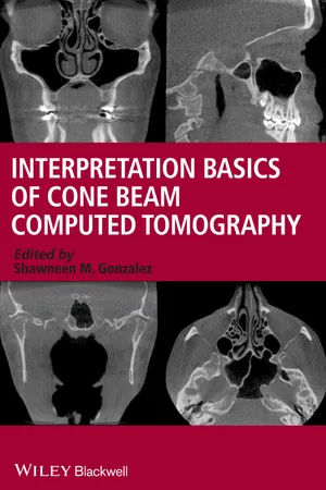 Interpretation Basics of Cone Beam Computed Tomography