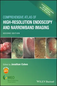 Comprehensive Atlas of High-Resolution Endoscopy and Narrowband Imaging_cover