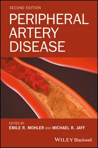 Peripheral Artery Disease_cover