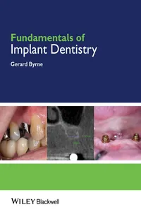 Fundamentals of Implant Dentistry_cover