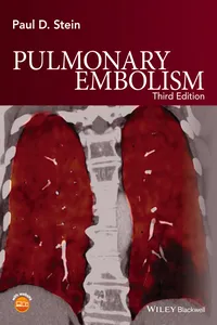 Pulmonary Embolism_cover