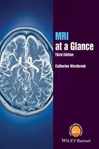 MRI at a Glance_cover