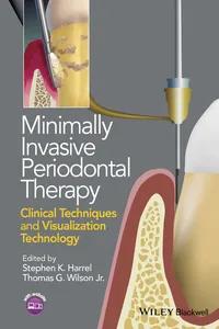 Minimally Invasive Periodontal Therapy_cover