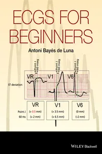 ECGs for Beginners_cover