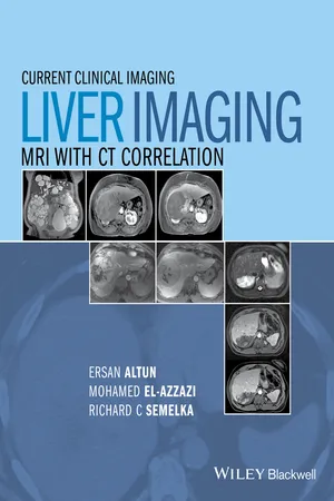 Liver Imaging