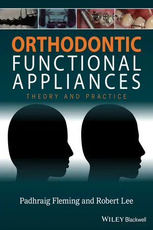 Orthodontic Functional Appliances