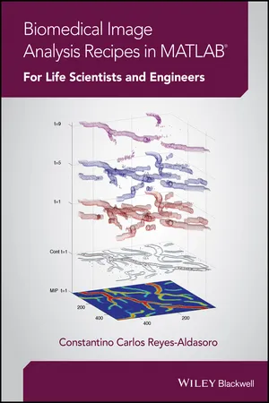 Biomedical Image Analysis Recipes in MATLAB