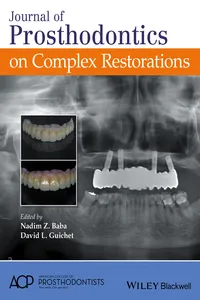 Journal of Prosthodontics on Complex Restorations_cover