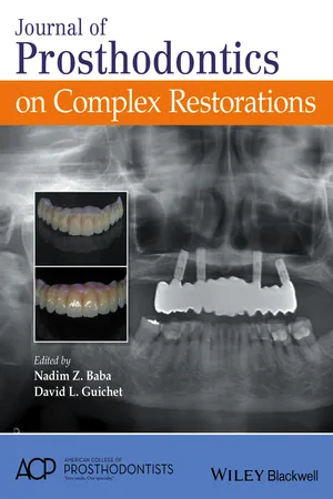 Journal of Prosthodontics on Complex Restorations