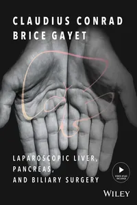 Laparoscopic Liver, Pancreas, and Biliary Surgery_cover