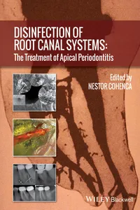 Disinfection of Root Canal Systems_cover