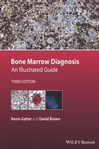 Bone Marrow Diagnosis_cover
