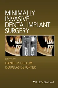 Minimally Invasive Dental Implant Surgery_cover