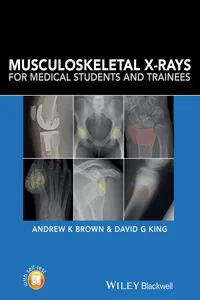 Musculoskeletal X-Rays for Medical Students and Trainees_cover