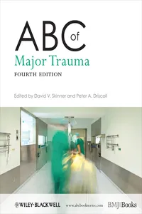 ABC of Major Trauma_cover